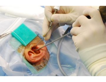 Переваги і показання до трансканальної ендоскопічної хірургії вуха